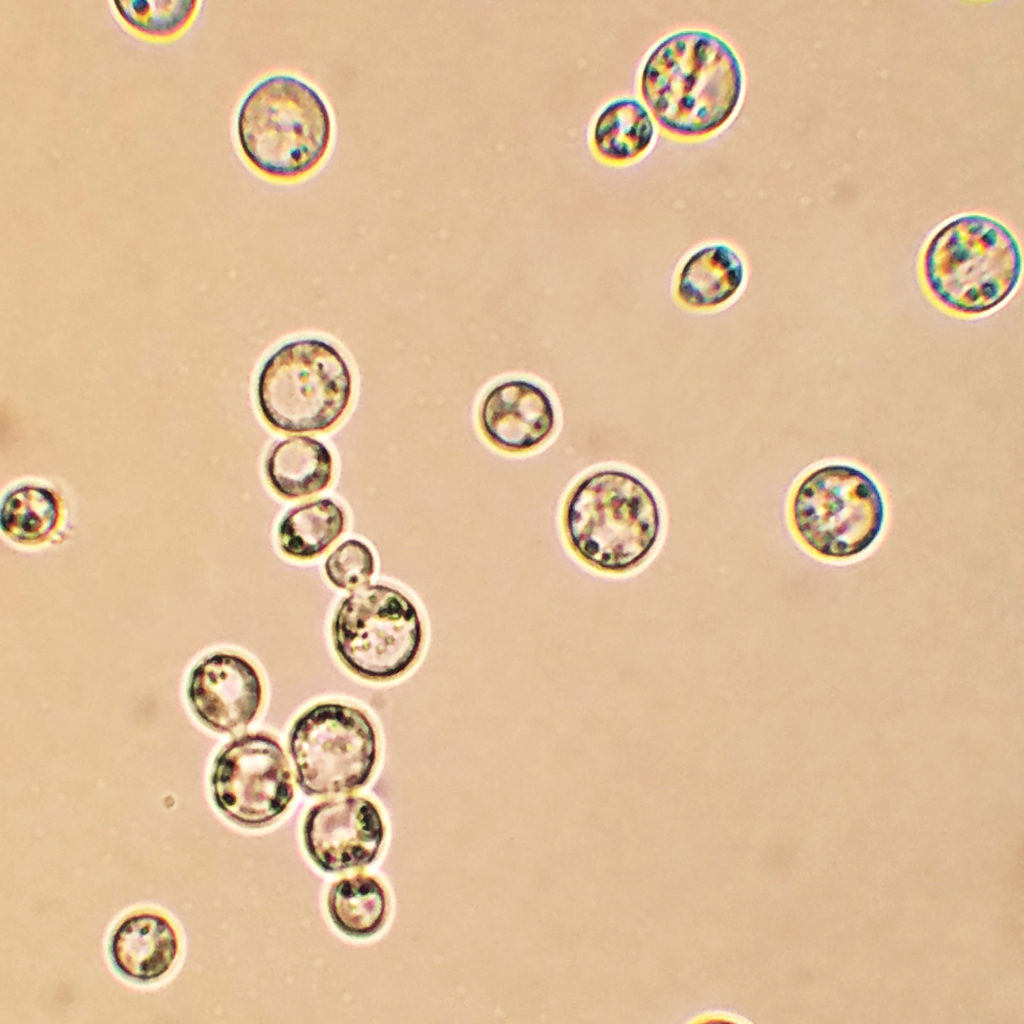 Yeast through microscope